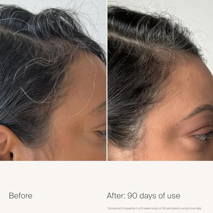 Living Proof Scalp Care Density Serum (50ml) – Serum für gesunde Kopfhaut & Haardichte – Gegen Haarausfall & graues Haar – Schnell einziehend & nicht ausspülbar – Bild 3