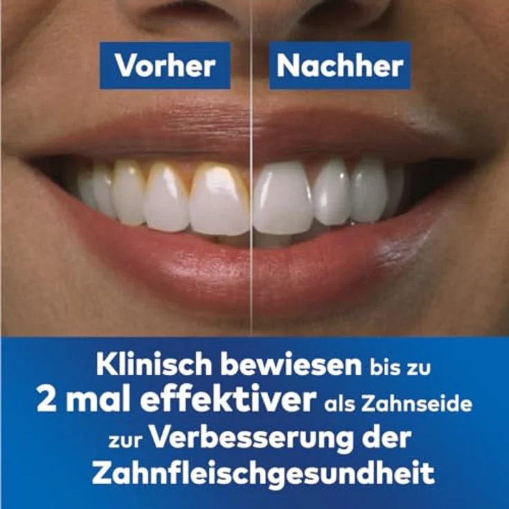 Waterpik Advanced Kabellose Munddusche, Water Flosser Testsieger 2024, 99,9% Plaque Entfernung, 4 Aufsätze, 3 Modi, Induktionsladesystem, Weiß – Bild 5