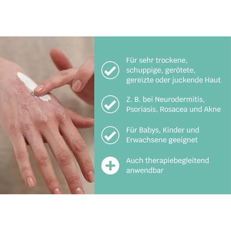 SIRIDERMA Intensiv-Pflegemaske Akut | ohne Duftstoffe | Basische Creme-Maske | 150 ml | Vegane Hautpflege für extrem irritierte und schuppende Haut – Bild 2