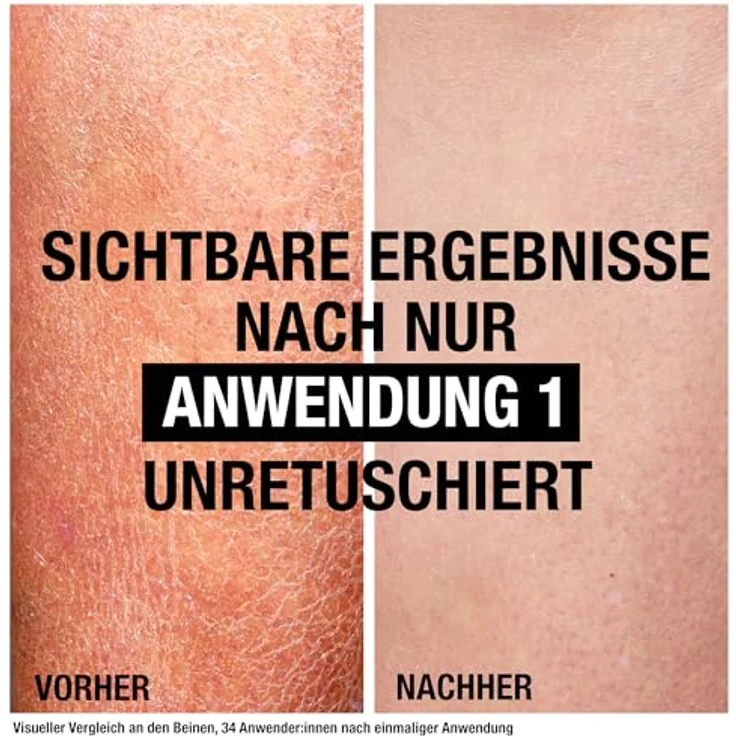 Neutrogena Norwegische Formel Deep Moisture Bodylotion, 400 ml, sofort einziehend, 72h intensive Feuchtigkeit für trockene Haut, hohe Verträglichkeit – Bild 3