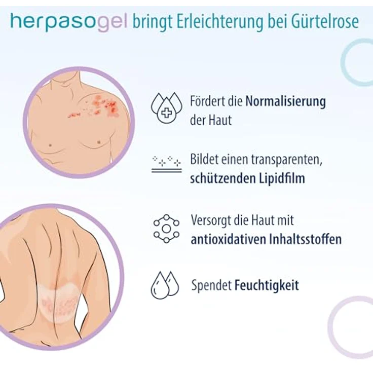 Evolsin Herpasogel bei Gürtelrose, medizinisches Gel zur Hautregeneration mit Hyaluronsäure, 50 ml – Bild 3