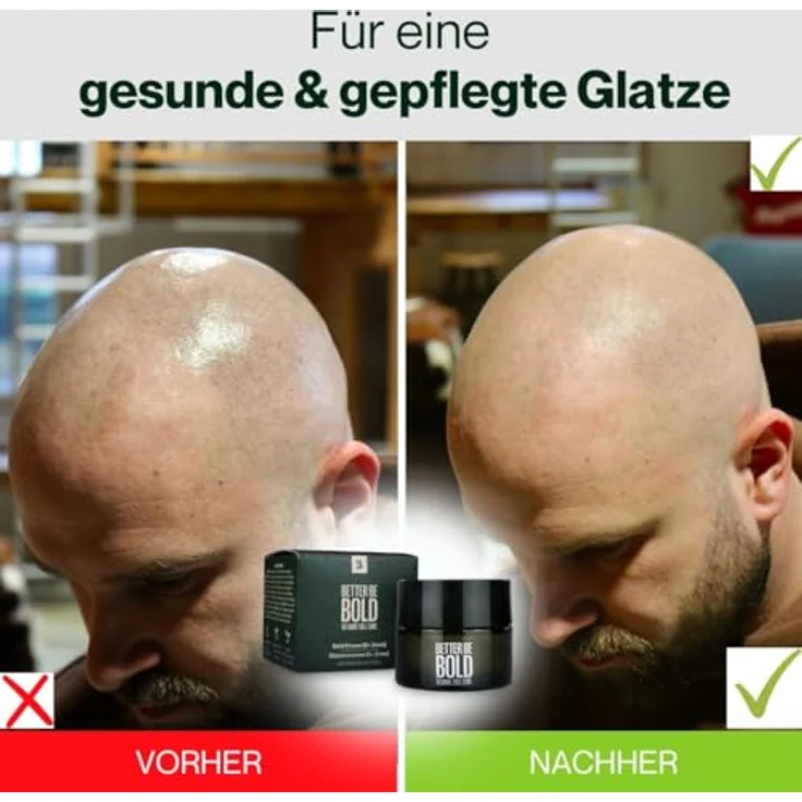 BETTER BE BOLD Kopfhautpflege No Hair. Full Care. Glatzencreme 50 ml – Bild 3
