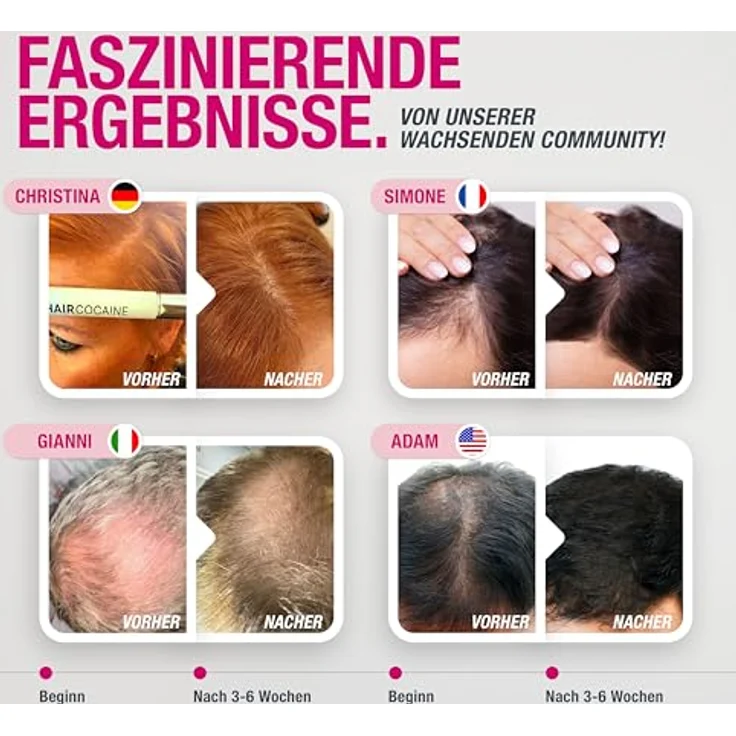 Svenja Walberg HAIRCOCA!NE Haarserum, Hochdosiertes Spot-Serum mit 5% Capixyl® zur Unterstützung des natürlichen Haarwachstums, Vegan, Made in Germany – Bild 4