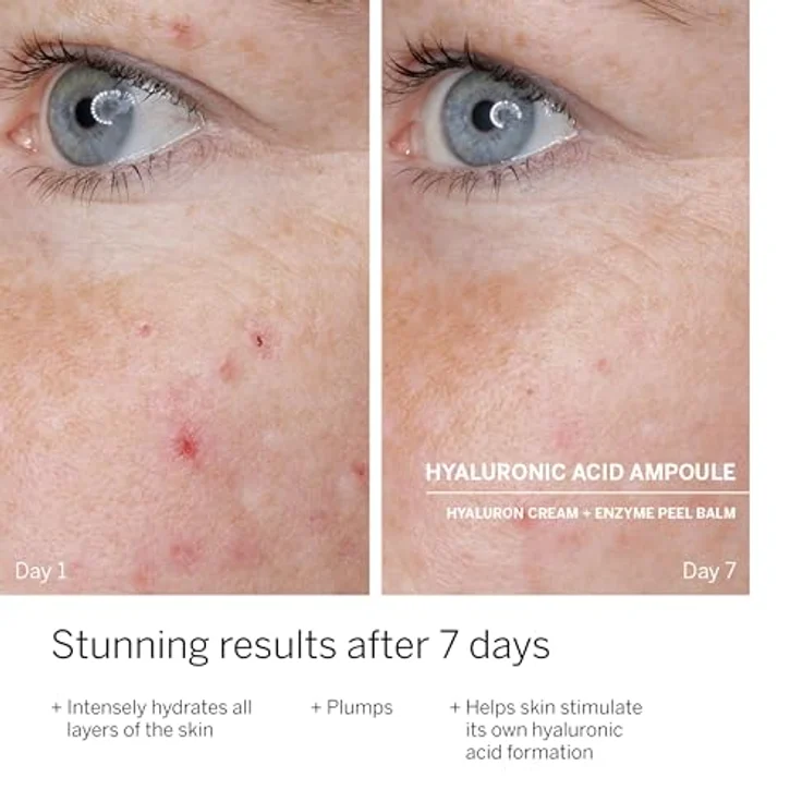 Babor Doctor Babor Power Serum Ampoules Hyaluronic Acid 14ml – Bild 5