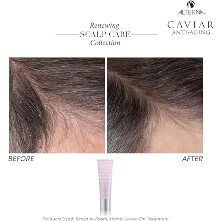Alterna Renewing Scalp Care Hemp Leave-on Treatment, feuchtigkeitsspendende Haarkur für trockene Kopfhaut, 74 ml – Bild 7