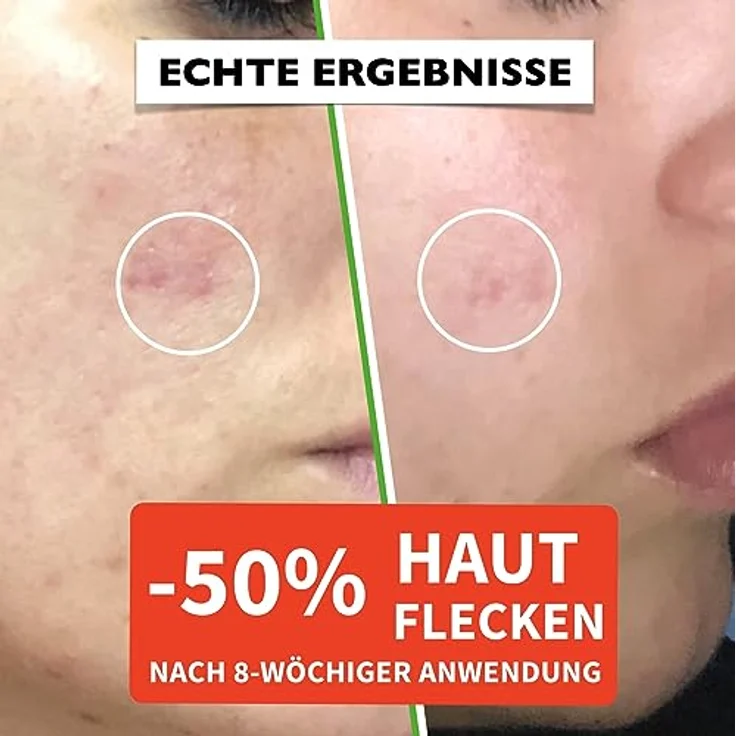 Florence BIO Hyaluron Serum mit Vitamin C/E hochkonzentriert für den Dermaroller geeignet mit organischen Anti-Aging Inhaltsstoffen – Bild 4