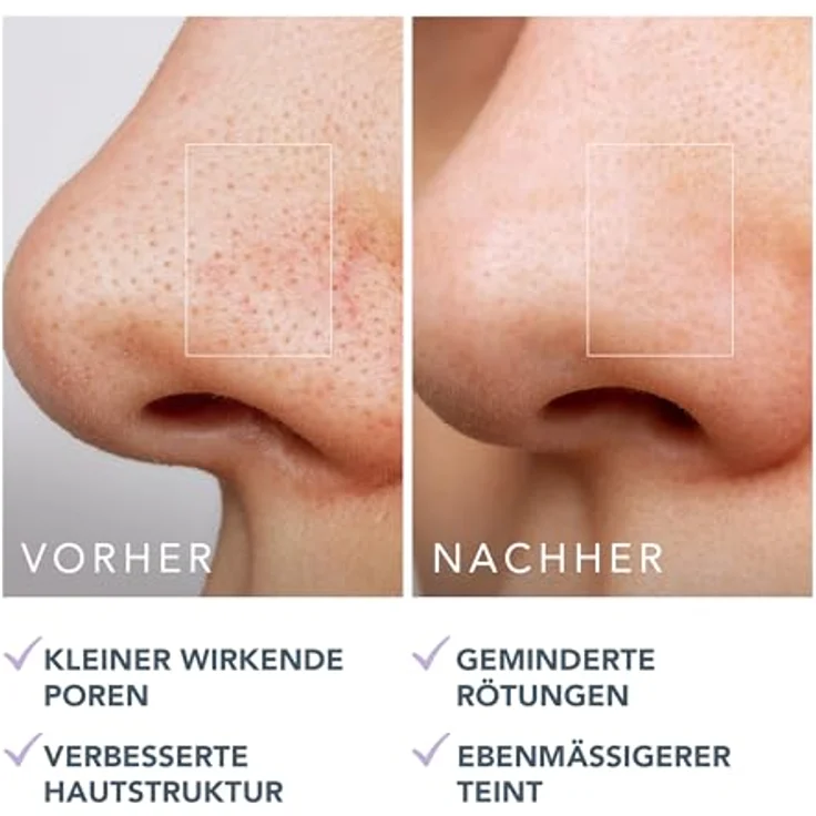 Foreo Pore Minimizing Toner Pads, Gesichtsreinigungsset für Damen mit natürlicher Formel, 120 g – Bild 6