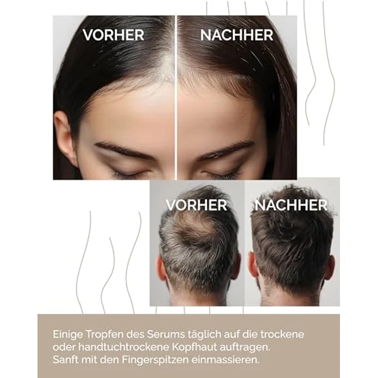 ALPINULIN Haar- & Kopfhautserum 50ml – Vegane Pflege mit Pflanzenextrakten, GHK-Cu & Alpenquellwasser gegen dünner werdendes Haar – Bild 4