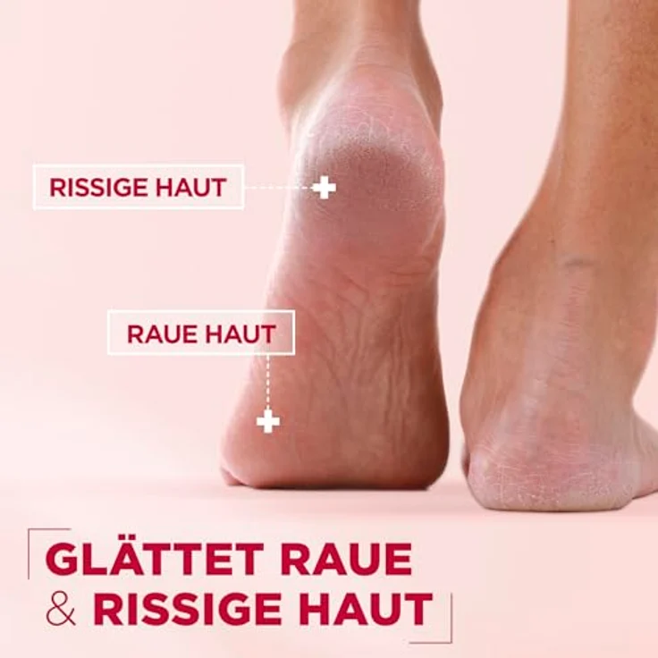 Mixa Urea Cica Repair+ Balsam, 40% Glycerin, Urea und Allantoin, reparierend und feuchtigkeitsspendend für sehr trockene Haut an Ellenbogen, Knie, Füßen & Händen, 150ml – Bild 3
