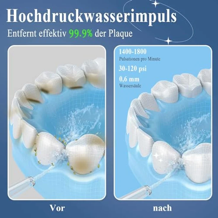 SURFOU Munddusche Kabellos Water Flosser, Elektrische Zahnreinigung mit 3 Reinigungsmodi, lange Akkulaufzeit, tragbar und wasserdicht – Bild 2