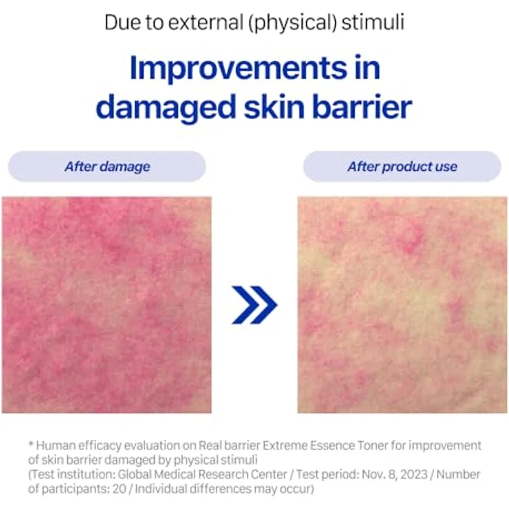 NoName REAL BARRIER Extreme Essence Toner, feuchtigkeitsspendendes Gesichtswasser für empfindliche und trockene Haut, 190 ml – Bild 5