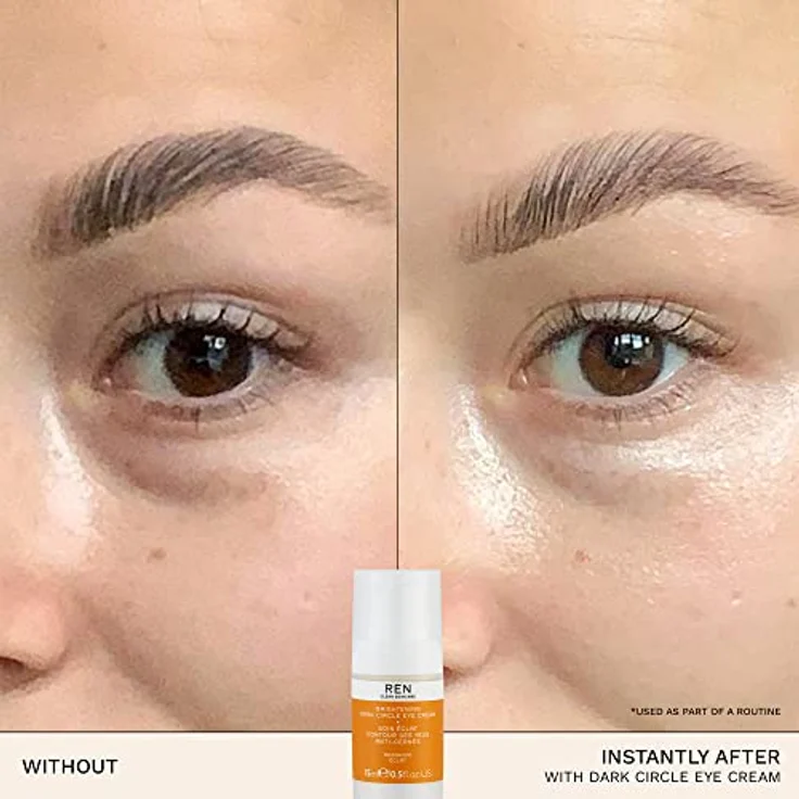 Ren Clean Skincare Radiance Brightening Dark Circle Eye Cream Augencreme 15 ml – Bild 4