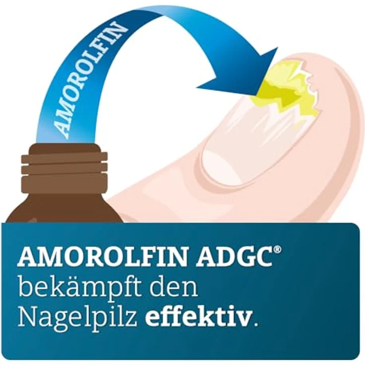 AMOROLFIN ADGC 50 mg/ml 5ml - wirkstoffhaltiger Nagellack zur effektiven Behandlung von Nagelpilz - Set mit 30 Einwegpfeilen, Alkoholtupfern und 10 Spateln - transparent & wasserfest – Bild 2
