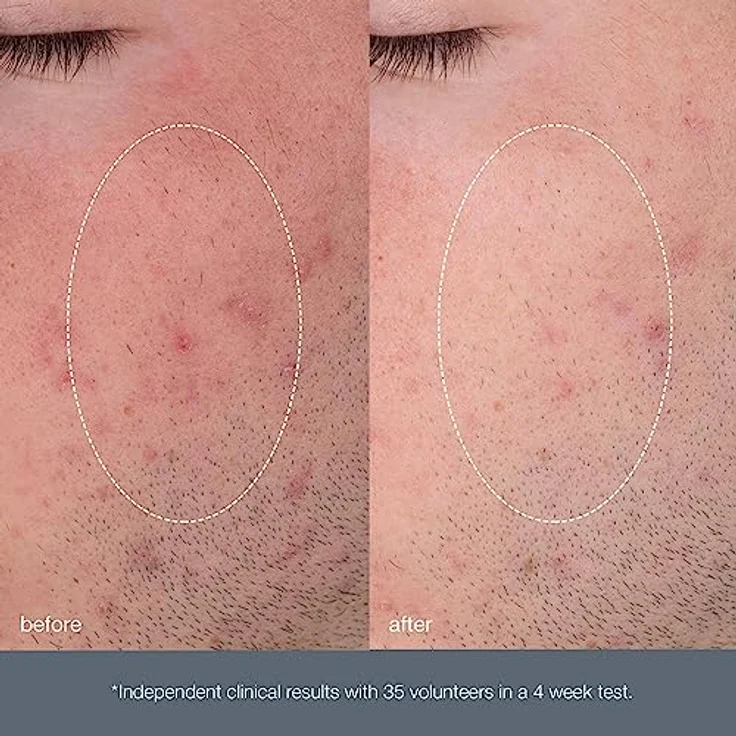 Dermalogica Exfoliants Daily Microfoliant Peeling 74 g, für alle Hauttypen geeignet – Bild 6
