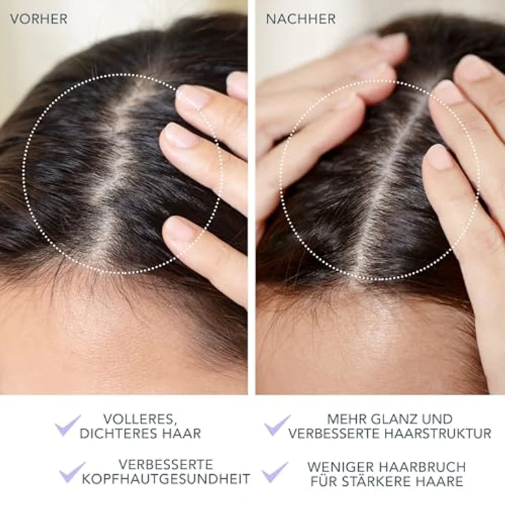 Foreo LUNA 4, Haar-Kopfmassagebürste mit LED-Technologie für Damen, 110 g – Bild 5