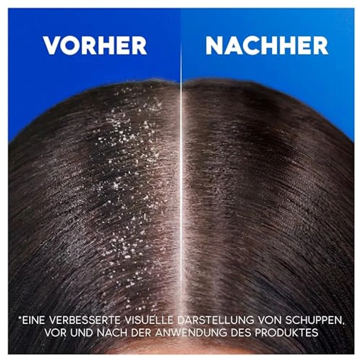 Head & Shoulders Refreshing Tea Tree Anti-Schuppen-Shampoo 300ml - Bis Zu 100% Schuppenschutz, Klinisch Getestet, Sauberes Frischegefühl – Bild 4