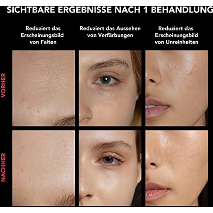 FAQ 202 Smart Anti Aging NIR + 7 LED Lichttherapiemaske fürs Gesicht - Flecken- und Aknebehandlung - Gesichtsmasken-Hautpflege - inkl. FAQ Silikon-Reinigungsspray 60 ml – Bild 4