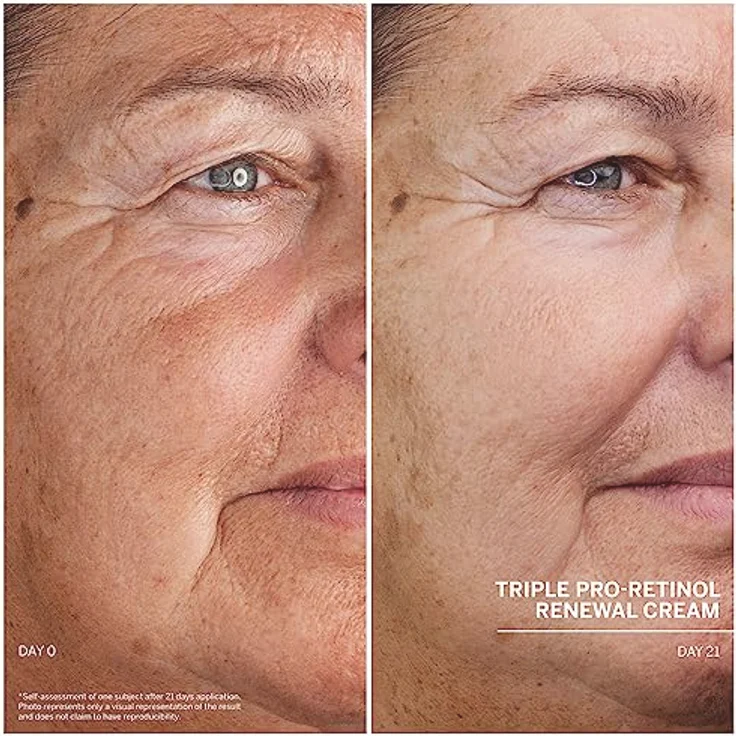 DOCTOR BABOR Straffende Creme mit Retinol, Anti-Aging Gesichtscreme für pralle Haut und gegen Hyperpigmentierung, Medizinische Anti-Falten Gesichtspflege, Triple Pro-Retinol Renewal Cream, 1 x 50 ml – Bild 4