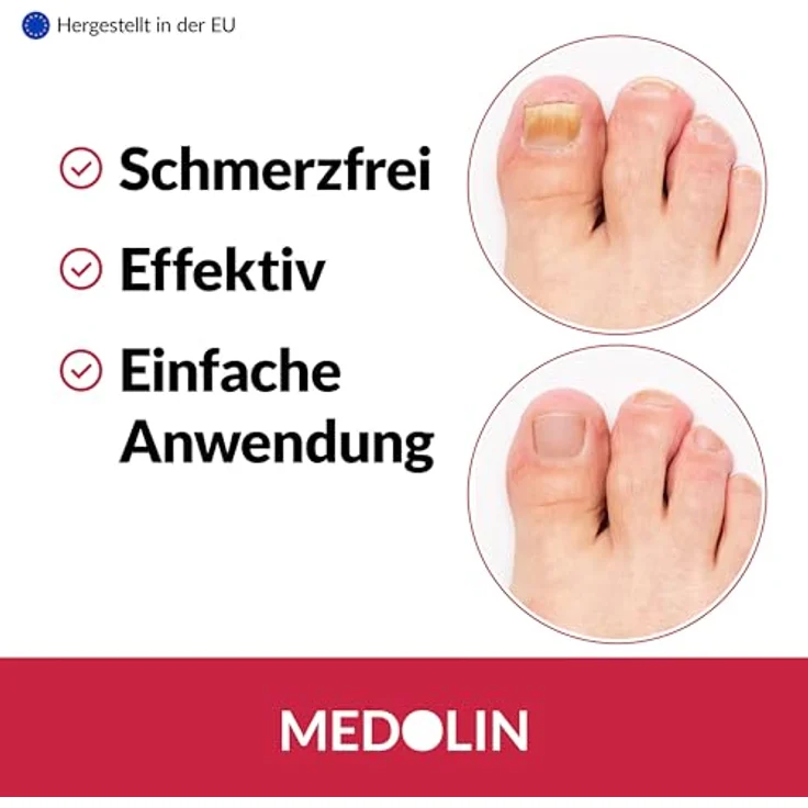 Medolin® Nagelpilz Lösung - Effektiver Nagellack mit belegter Wirkweise - Lack Behandlung für schöne & gepflegte Nägel - Geeignetes Mittel für Fuß & Hand | Nagelhärter, 10 ml – Bild 4