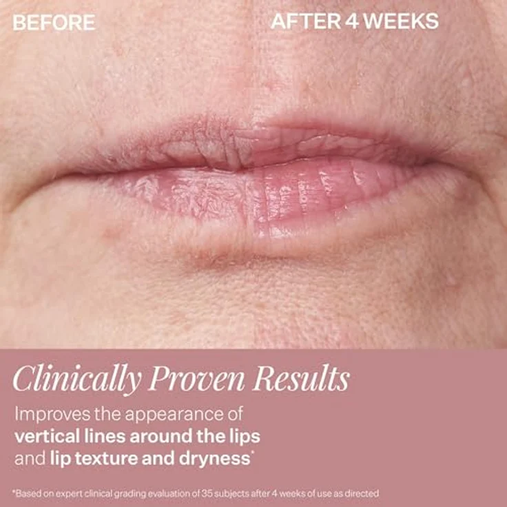 Strivectin Gesichtspflege Eye & Lip Care Double Fix Plumping & Vertical Line Lip Treatment 10 ml – Bild 6