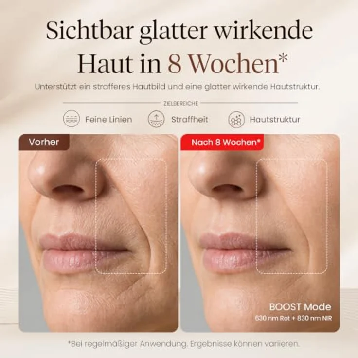 BOB AND BRAD PhysioFace LED Gesichtsmaske mit Rotlicht & Nahinfrarot, 4 Wellenlängen, 3 Modi, 10-Min.-Anwendung, Silikon-Augenpolster & verstellbares Kopfband, 480 LEDs für Hautpflege – Bild 3