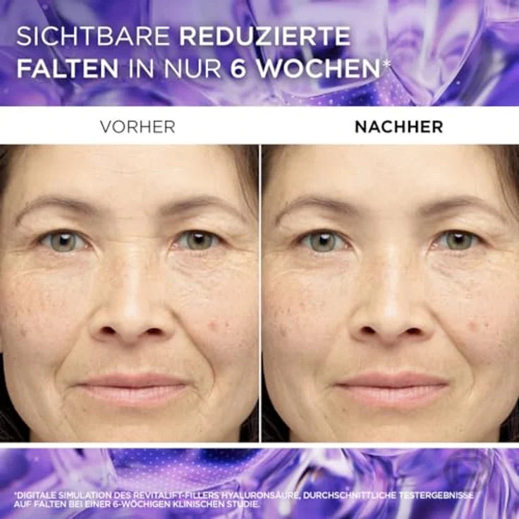 L'Oréal Paris Revitalift Filler HA 1,5%, Gesichtsserum mit Hyaluronsäure, 50 ml – Bild 4