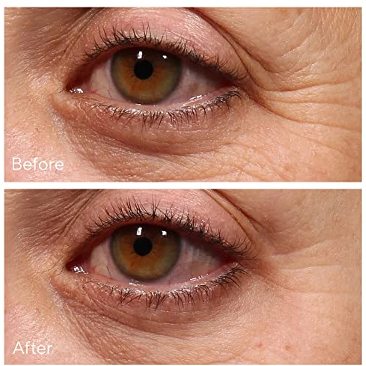Murad Resurgence Retinol Youth Renewal Eye Serum - Anti-Aging Serum für Augen- und Augenlider, 15 ml – Bild 2