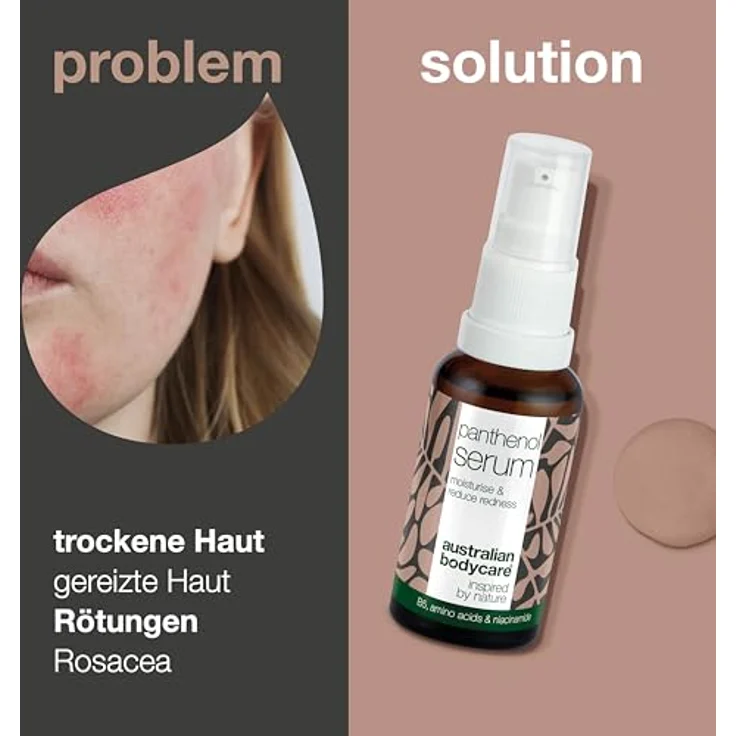 Australian Bodycare Anti-Rötungen Panthenol Serum bei Rosacea, mindert Rötungen im Gesicht, 30 ml, mit Provitamin B5 und Niacinamid – Bild 2