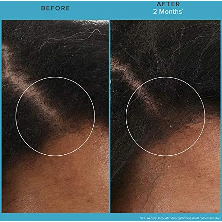 Living Proof Scalp Care Revitalizing Treatment 73 ml – Bild 3