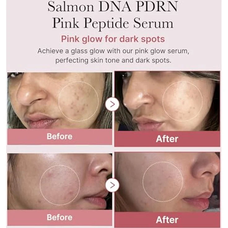 medicube - PDRN Pink Peptide Serum, 30 ml - Straffendes und beruhigendes Serum für verbesserte Hautelastizität – Bild 2
