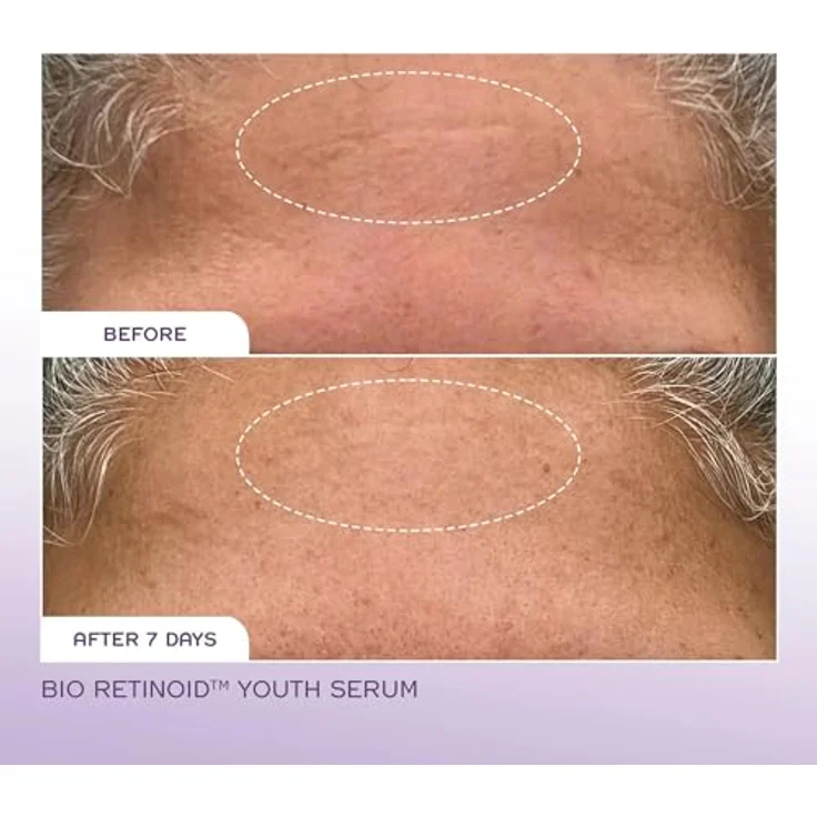 REN Bio Retinoid Youth Serum 30 ml – Bild 2