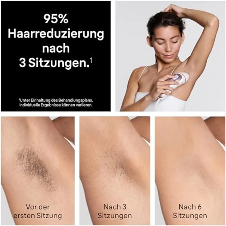 Braun Smart IPL Skin i-expert Pro 7 PL7211, Licht-Haarentferner mit präzisem Behandlungskopf und Hauttonerkennung – Bild 5