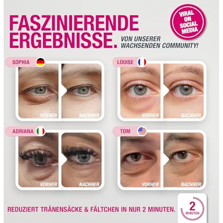 Svenja Walberg EYEBAGHACK, Express Eyelift Effect gegen Tränensäcke & Fältchen, Invisible Flex Film Technology für bis zu 10h Wirkung, 5x 1ml Mini-Tuben – Bild 5