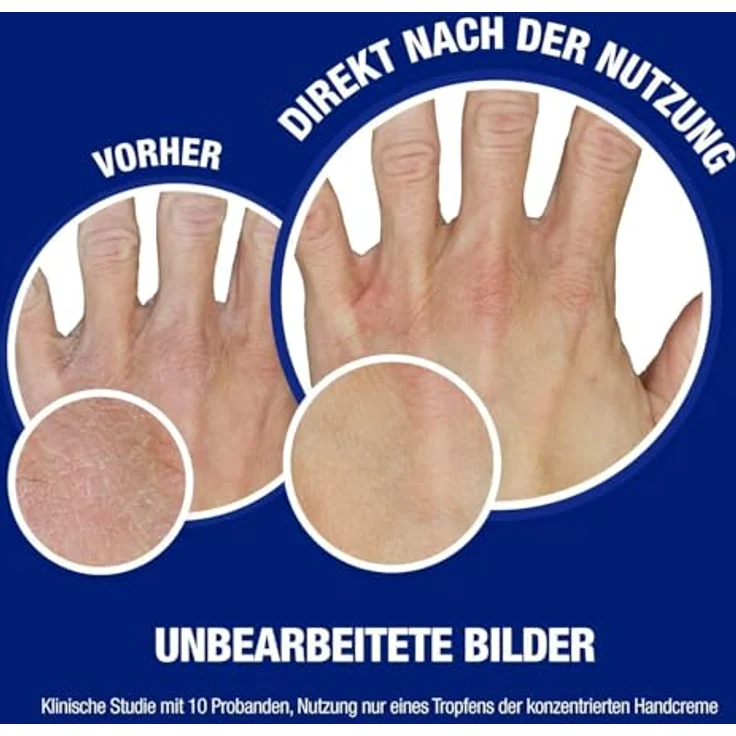 Neutrogena Sofort einziehende Handcreme (150ml), leichte & nicht fettende Feuchtigkeitscreme mit Glycerin + Vitamin E bei trockenen, rissigen Händen – Bild 2
