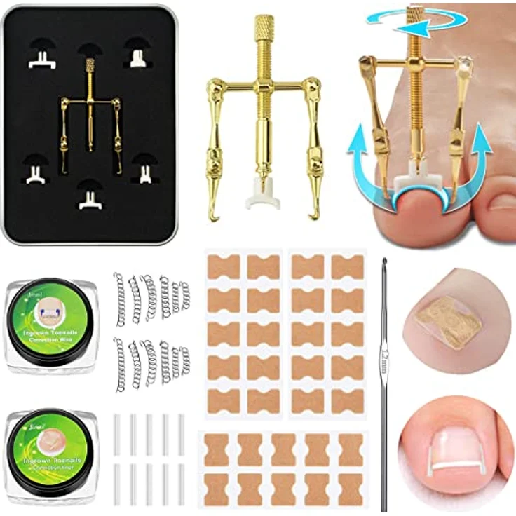 Leikedun Eingewachsene Zehennägel Set, Professionelles Fusspflege Set mit Edelstahl Werkzeugen und Korrekturaufklebern, 30 Stück Nagelpatches und 10 Korrekturstreifen – Bild 1