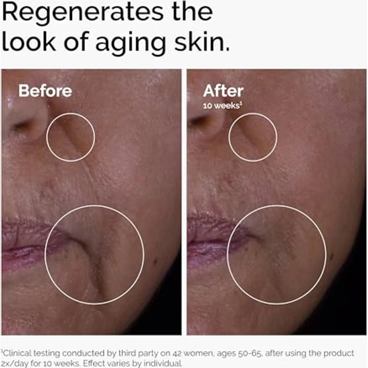 The Ordinary | GF 15% Lösung | Regenerierende Gesichtspflege, 30 ml – Bild 4