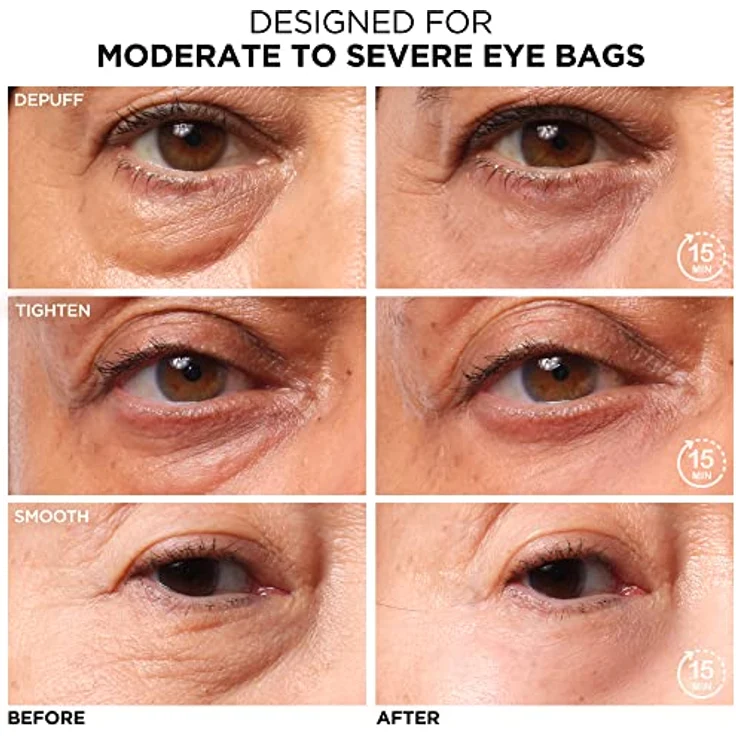 IT Cosmetics, Exklusive Behandlung für Beutel, Lifing-Effekt, entzündungshemmend, Bye Bye Under Eye Bags, 15 ml – Bild 2