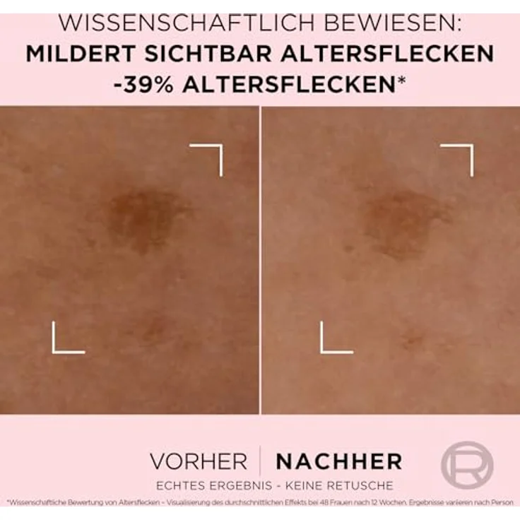 L'Oréal Paris Age Perfect Golden Age Anti-Altersflecken Fluid, strahlender Teint, 30ml – Bild 5