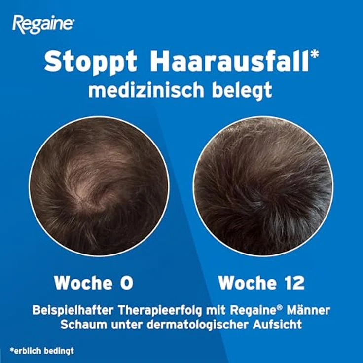 Regaine Männer Lösung: Mit 50 mg/ml Minoxidil (5%), 60 ml zur Behandlung erblich bedingtem Haarausfall – Bild 5
