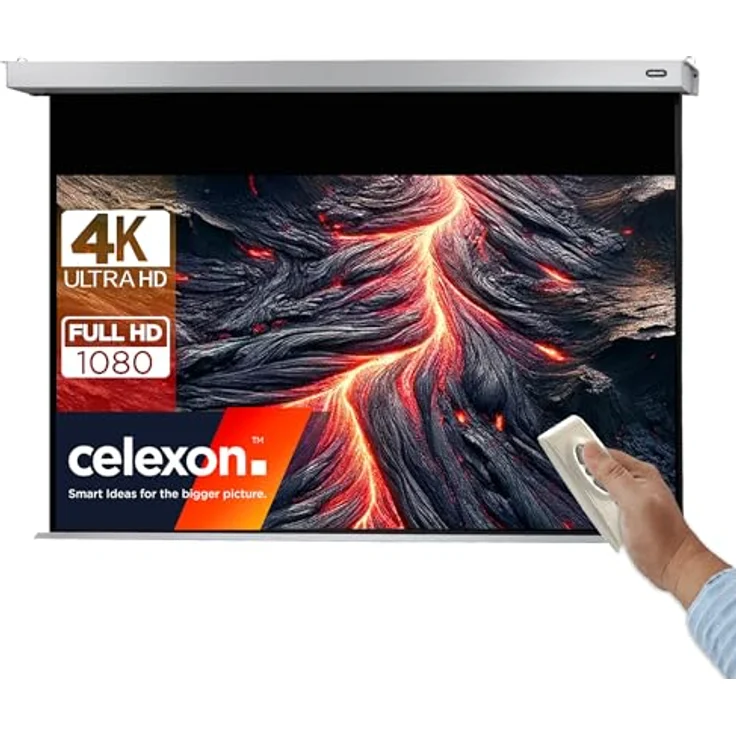 Celexon Motor Professional Plus 160x90 – Bild 2