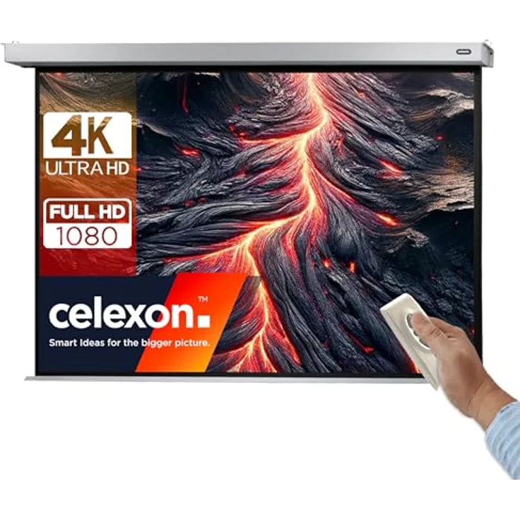 Celexon Motor Professional Plus 280x210 – Bild 2