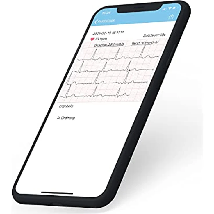 Pulox PM10 Mobiles EKG und Pulsoximeter, tragbares Gesundheitsgerät mit Bluetooth, EKG-Aufzeichnung und Herzfrequenzanalyse – Bild 4