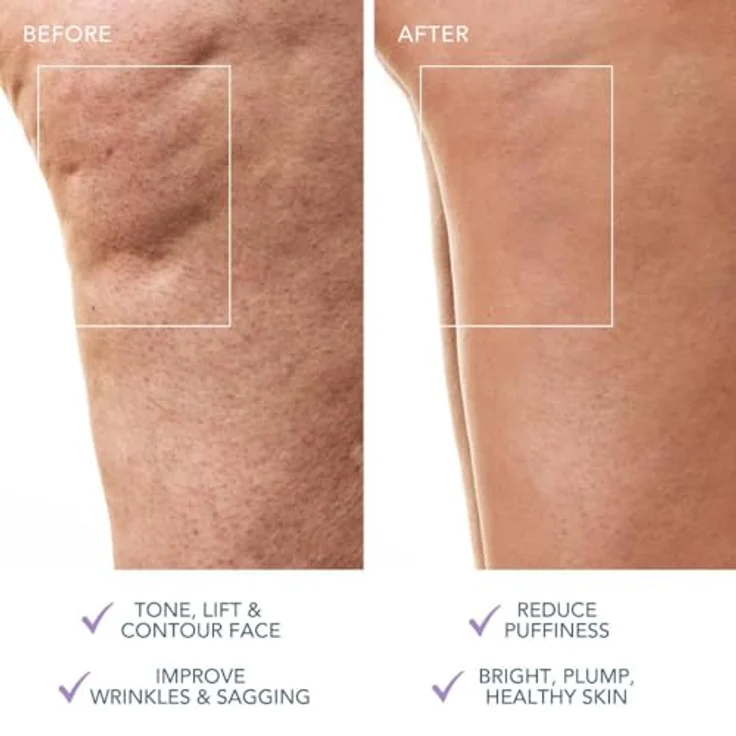 FOREO BEAR™ 2 body, Körperstraffungsgerät mit Mikrostrom und T-Sonic™ Massage, lavendel – Bild 6