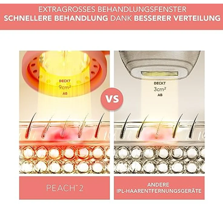 FOREO PEACH 2 IPL-Gerät zur Haarentfernung - Alternative zur Laser-Haarentfernung und Epilierern für Damen - Dauerhafte Haarentfernung für Körper & Gesicht - 10-Minuten-Behandlung - Kabelgebunden – Bild 3