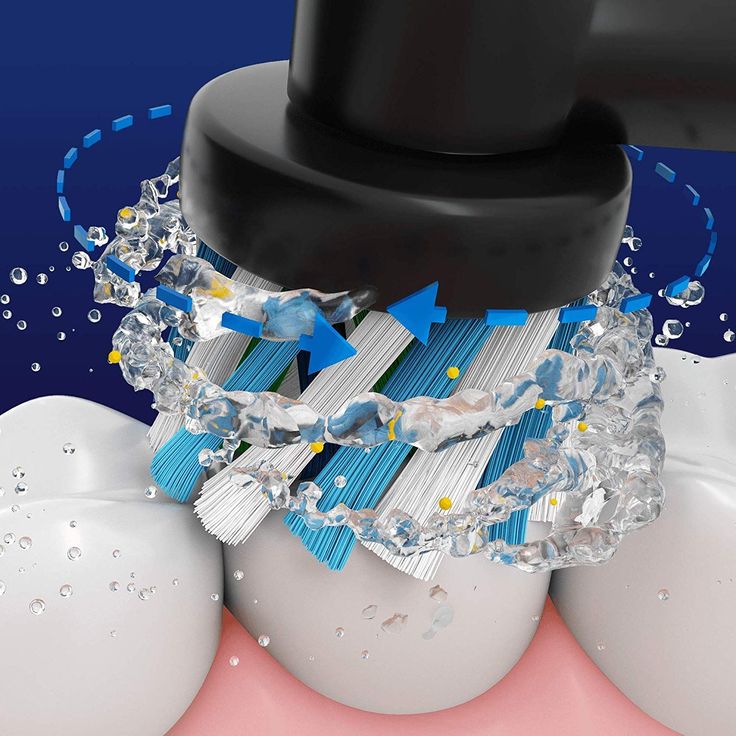 Oral-B Genius X 20100S black mit künstlicher Intelligenz, Bluetooth & visueller Andruckkontrolle – Bild 5