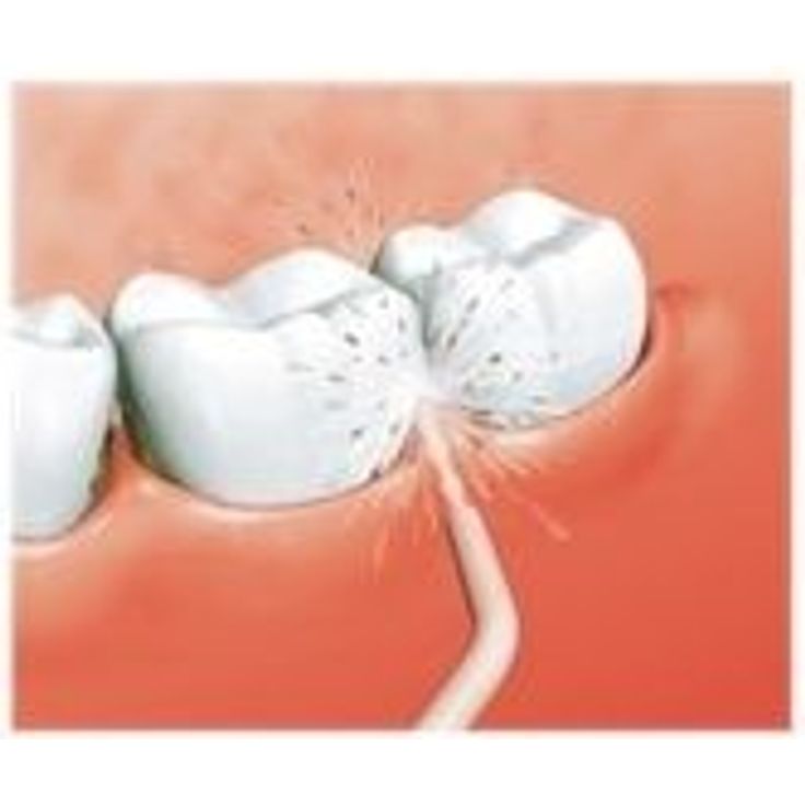 Panasonic EW0955-W für Mundduschen 2er-Pack, für eine tiefengründliche Reinigung – Bild 2