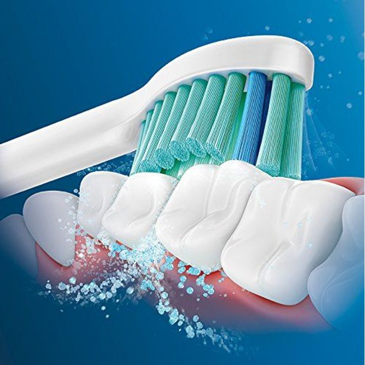 Philips Sonicare HX6018/07 ProResults, bis zu 2x mehr Plaqueentfernung, 8er-Pack, weiß – Bild 2