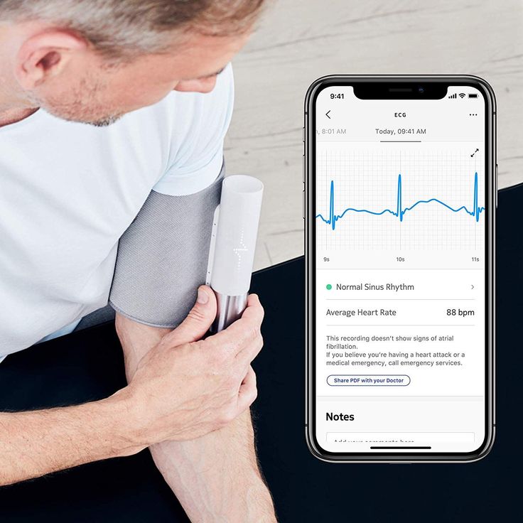 Withings BPM Core - Intelligentes Blutdruckmessgerät mit EKG-Funktion und digitalem Stethoskop – Bild 9