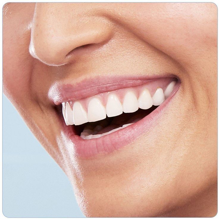 Oral-B Pro 900 Sensi UltraThin, Für eine sanfte Reinigung am Zahnfleischrand, weiß – Bild 4