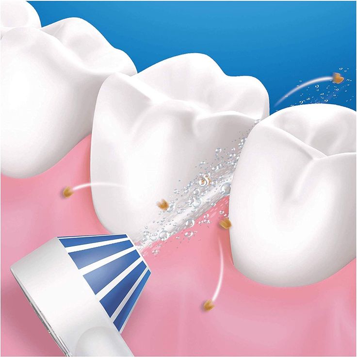 Oral-B AquaCare 4 Kabellose Munddusche mit Oxyjet-Technologie, für gesünderes Zahnfleisch – Bild 2